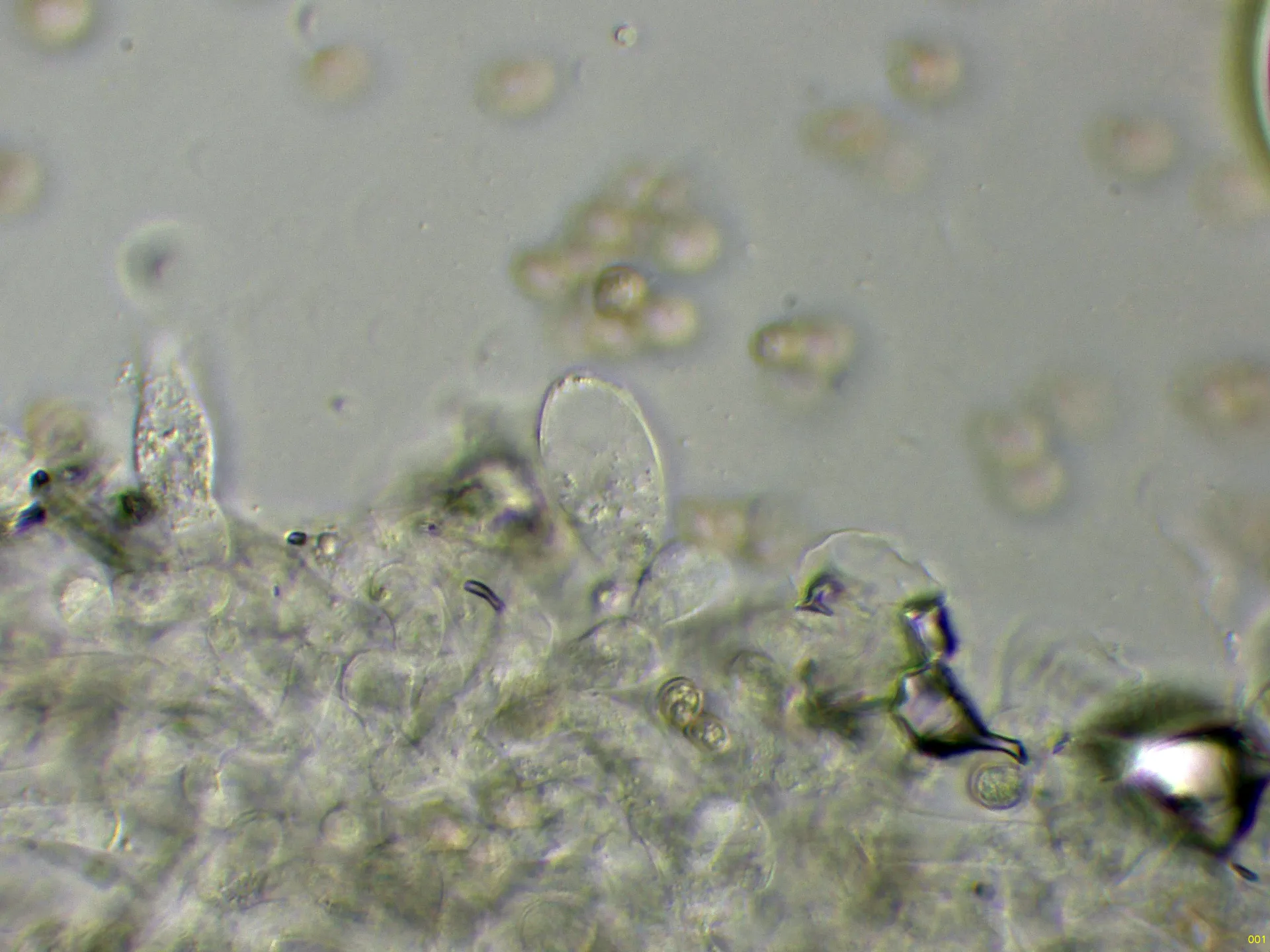 Microscopía de Pluteus longistriatus - 10 - Arista amoniaco-001
